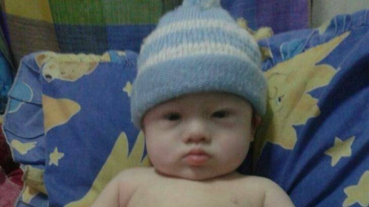Abandoned by his parents: Six-month old Gammy has Down syndrome.