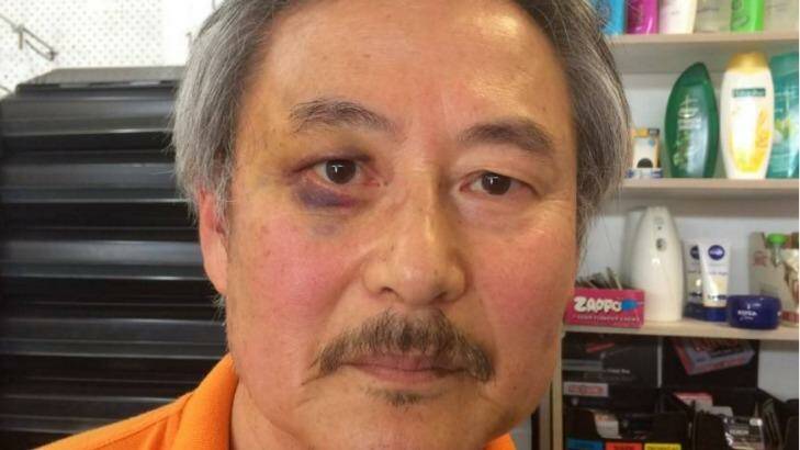 Former Korean Army lieutenant, high school teacher and counsellor Paul Shin shows off a black eye after a vicious attack by a 17-year-old in his general store. Photo: Newcastle Herald